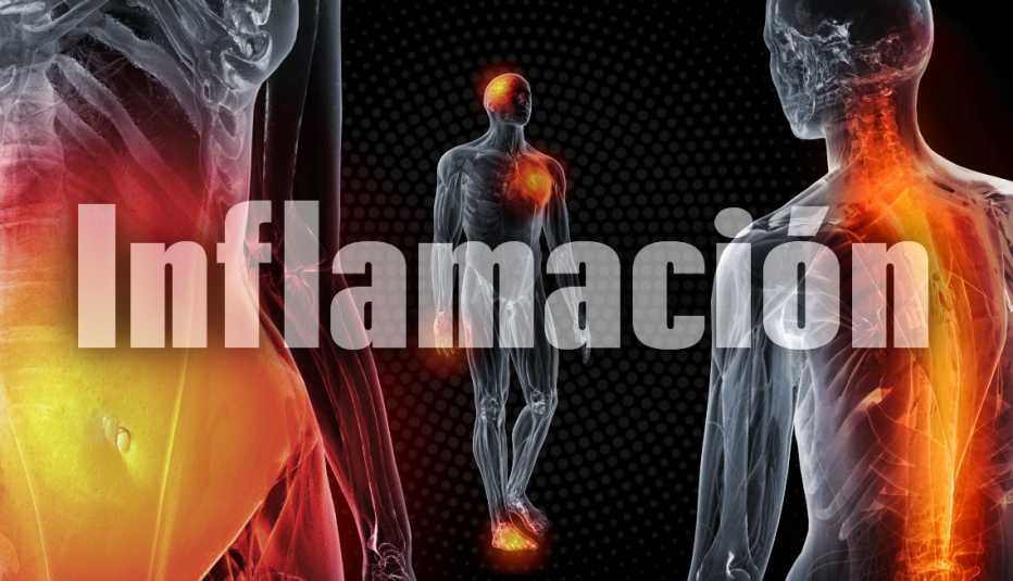 Cómo reducir la inflamación del cuerpo de forma natural