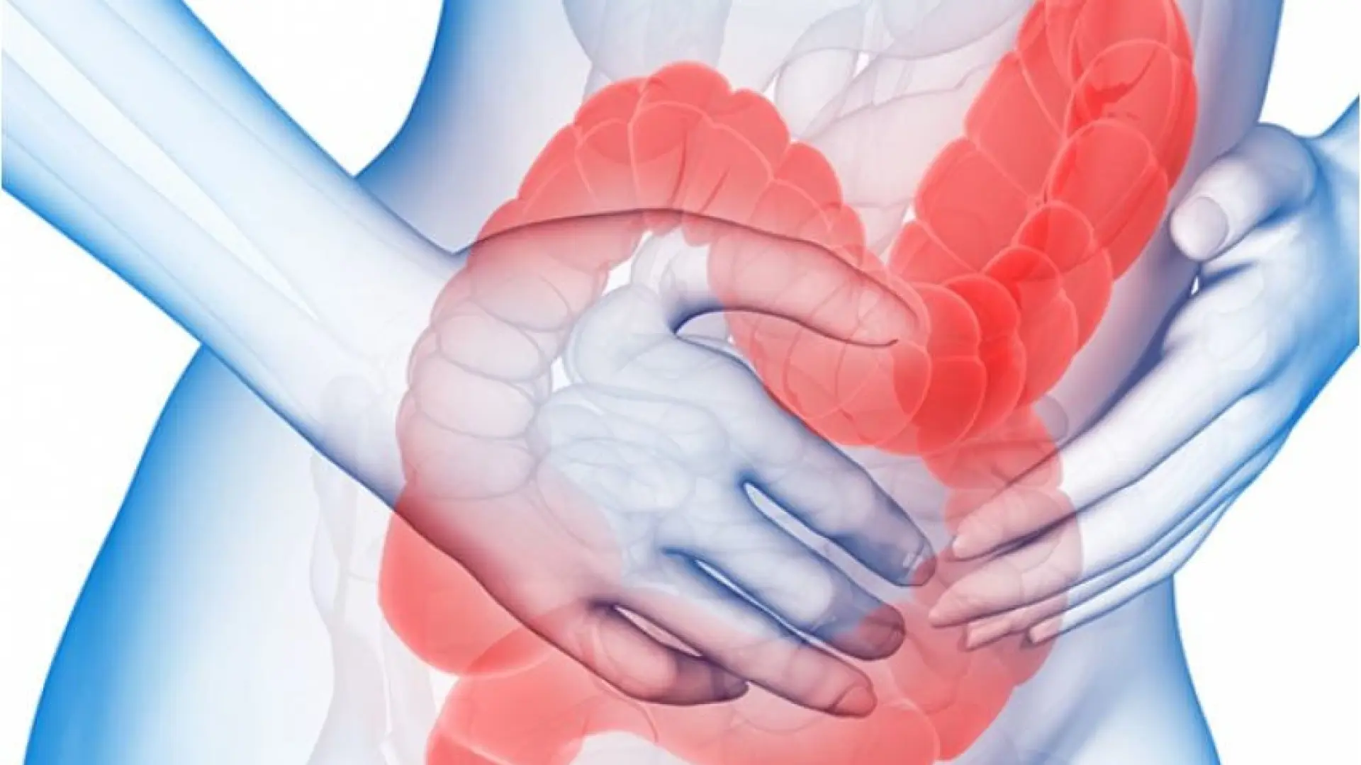 Cómo tratar naturalmente los síntomas del colon irritable